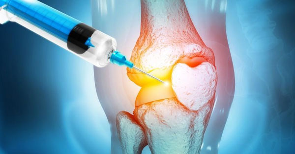 PRP therapy for Knee joint pain